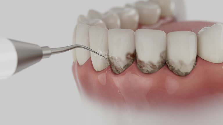 Reliable Dental contractor in Boulder, MT by Dentist Open Now